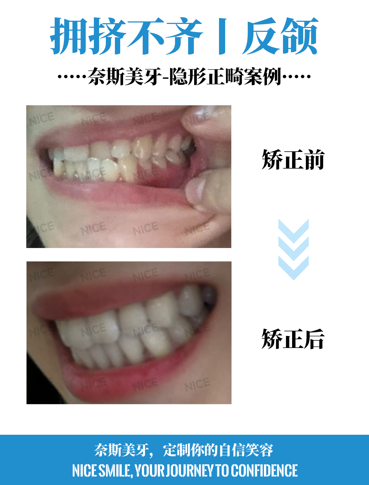 侧面对比